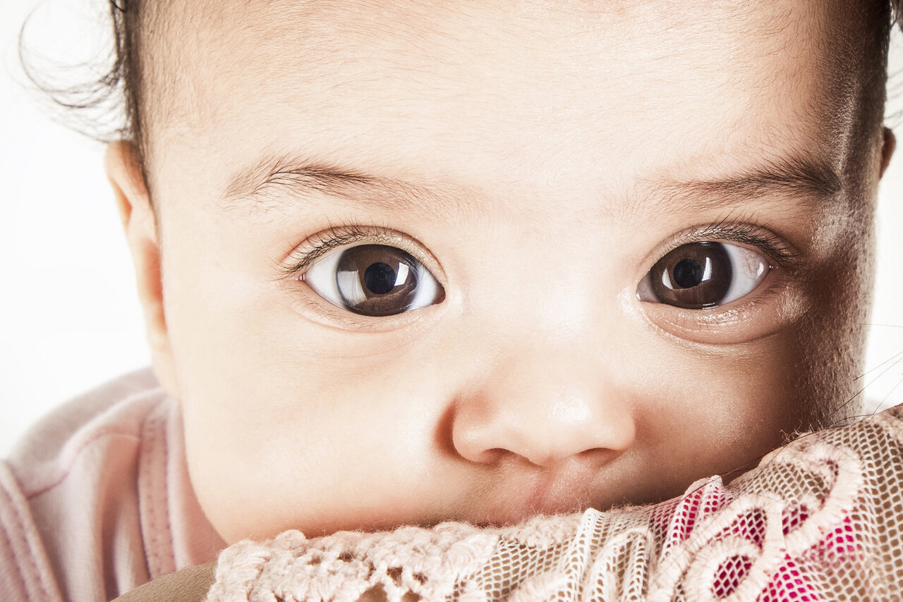 Estrabismo em bebês: quando o desvio dos olhos é normal e quando preocupa